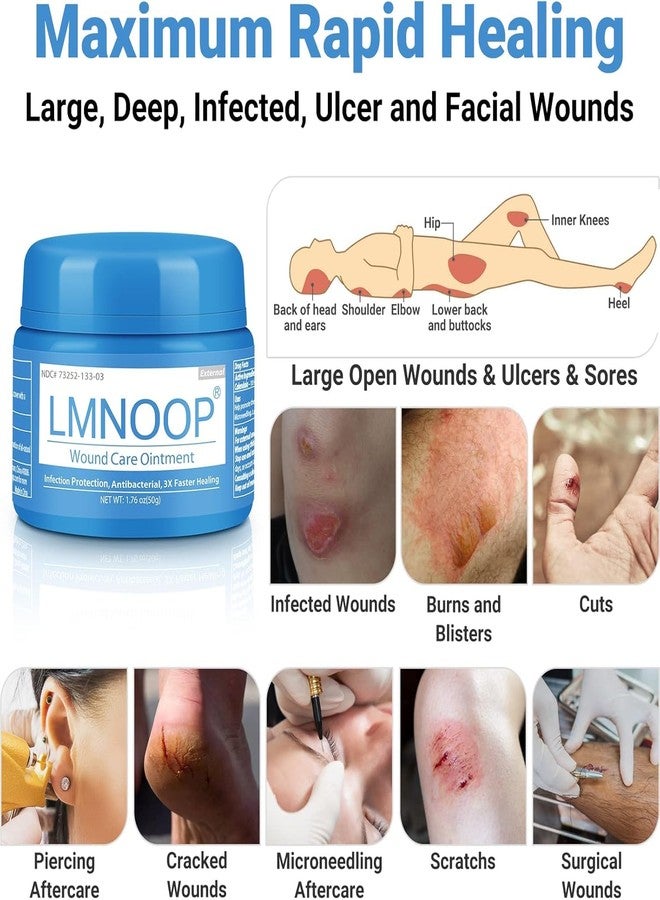 لمنوب مرهم LMNOOP® لعلاج الجروح، للجروح المزمنة، وقرح الفراش، وقرح الجلد، والتهاب النسيج الخلوي، والحروق، والقروح، والجروح الجراحية، والجروح المصابة، والخدوش، والفقاعات، وتسكين الألم، ومضاد للعدوى، وكريم مضاد للالتهابات - Image 2
